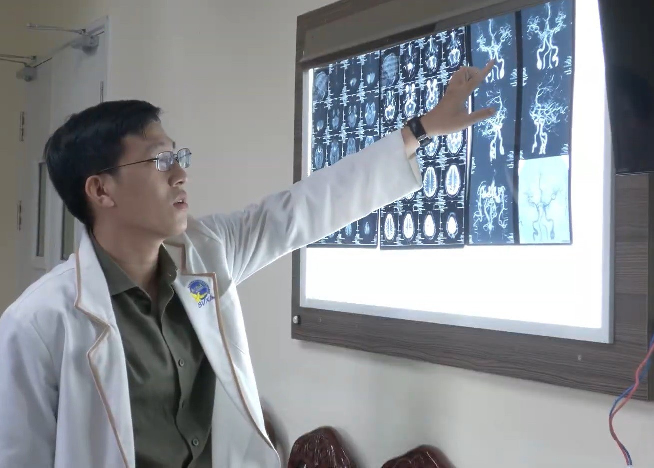 Đang đá bóng, thanh niên đột quỵ ngay trên sân- Ảnh 1.