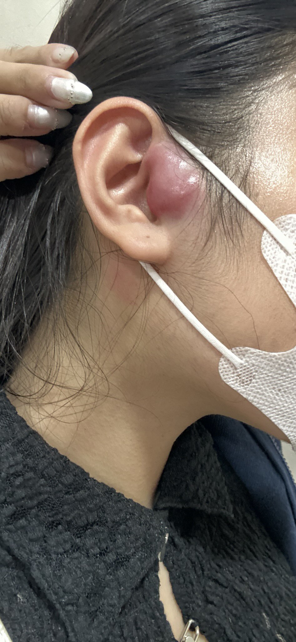Cô gái TP.HCM 24 tuổi bị ung thư hạch giai đoạn 4: Bác sĩ nói lý do có thể đến từ... mọi thứ- Ảnh 3. Cô gái TP.HCM 24 tuổi bị ung thư hạch giai đoạn 4: Bác sĩ nói lý do có thể đến từ... mọi thứ- Ảnh 3.