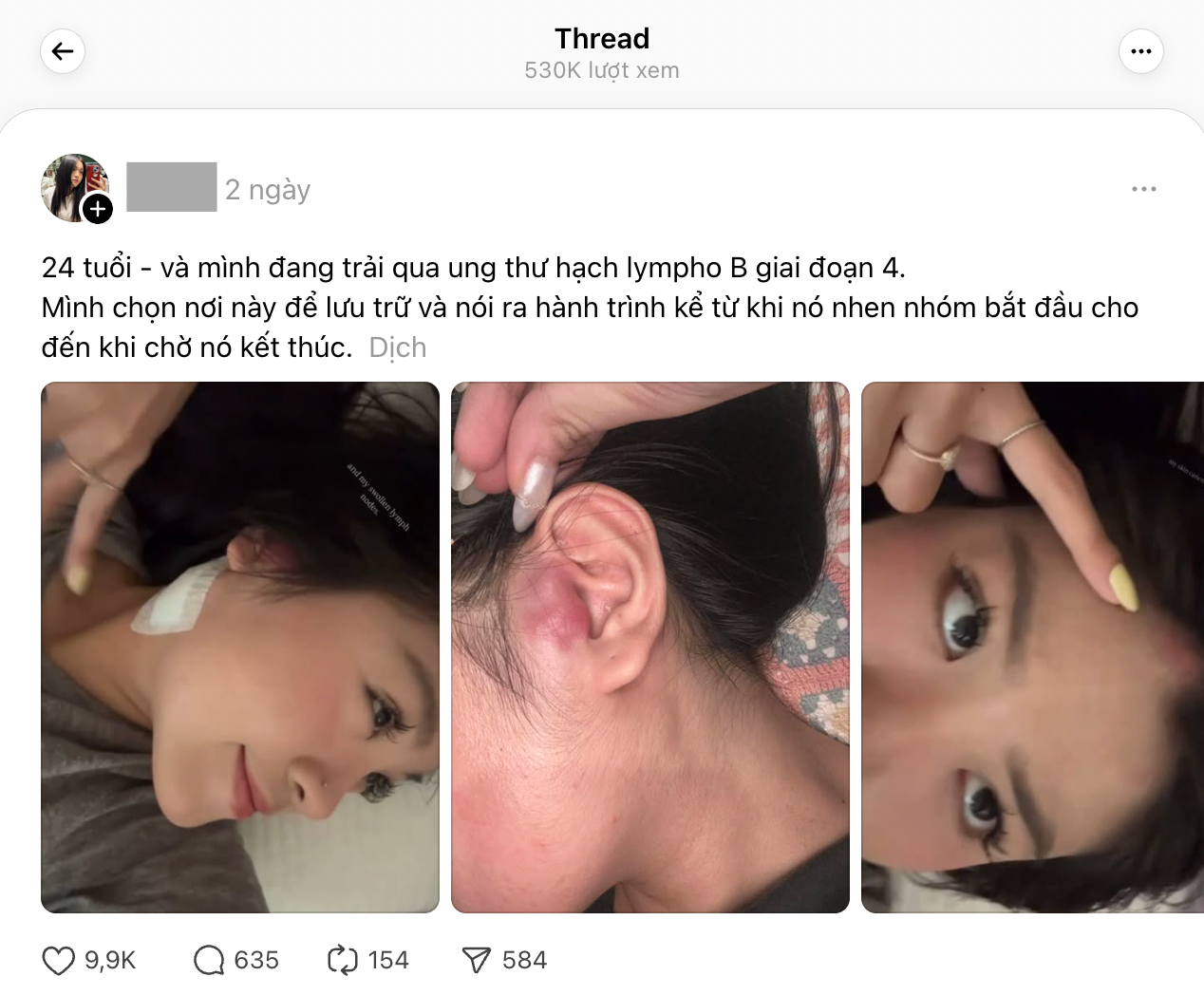 Cô gái TP.HCM 24 tuổi bị ung thư hạch giai đoạn 4: Bác sĩ nói lý do có thể đến từ... mọi thứ- Ảnh 2. Cô gái TP.HCM 24 tuổi bị ung thư hạch giai đoạn 4: Bác sĩ nói lý do có thể đến từ... mọi thứ- Ảnh 2.