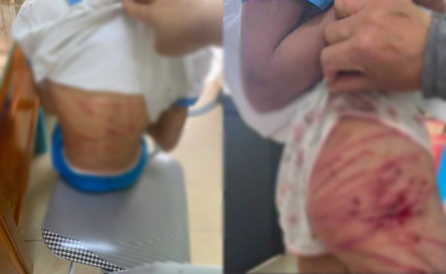 B&eacute; g&aacute;i lớp 5 nghi bị cha dượng bạo h&agrave;nh: Hiệu trưởng trường chia sẻ th&ocirc;ng tin sốc- Ảnh 1.