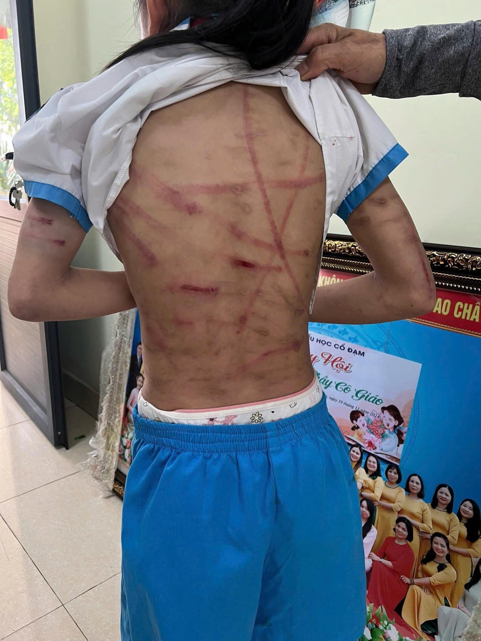 Vụ bé gái lớp 5 ở Hà Tĩnh bị bạo hành: Công an làm việc với người cha dượng- Ảnh 5.
