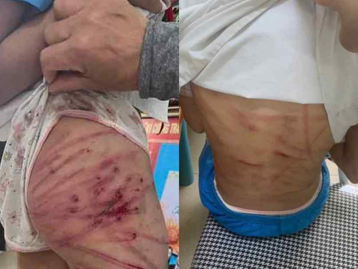 Lời khai của Nguyễn Văn Nam - gã cha dượng đánh đập bé gái lớp 5 dã man- Ảnh 2. Lời khai của Nguyễn Văn Nam - gã cha dượng đánh đập bé gái lớp 5 dã man- Ảnh 2.