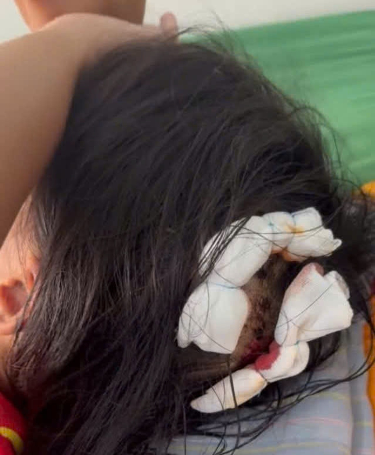 Vụ bé gái lớp 5 ở Hà Tĩnh bị bạo hành: Công an làm việc với người cha dượng- Ảnh 3.