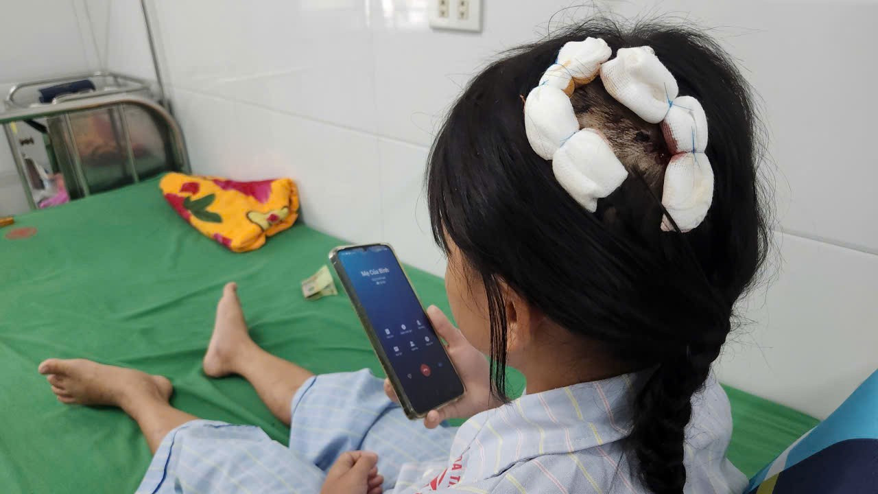 Bé Gái Bị Cha Dượng Dùng Búa Bạo Hành: Lời Kể Nghẹn Ngào Của Nạn Nhân- Ảnh 1. Bé Gái Bị Cha Dượng Dùng Búa Bạo Hành: Lời Kể Nghẹn Ngào Của Nạn Nhân- Ảnh 1.