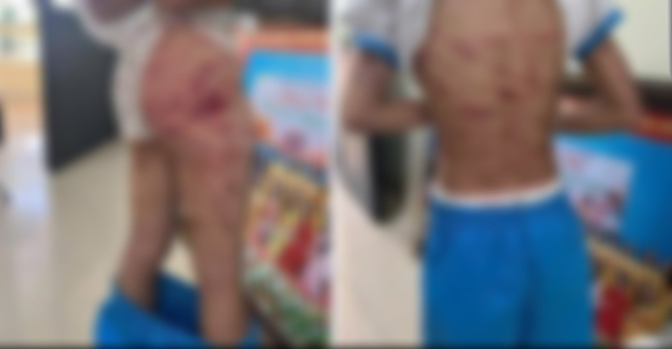 Vụ cha dượng bạo hành bé gái lớp 5: 'Đây không phải lần đầu trẻ bị đánh'- Ảnh 1.