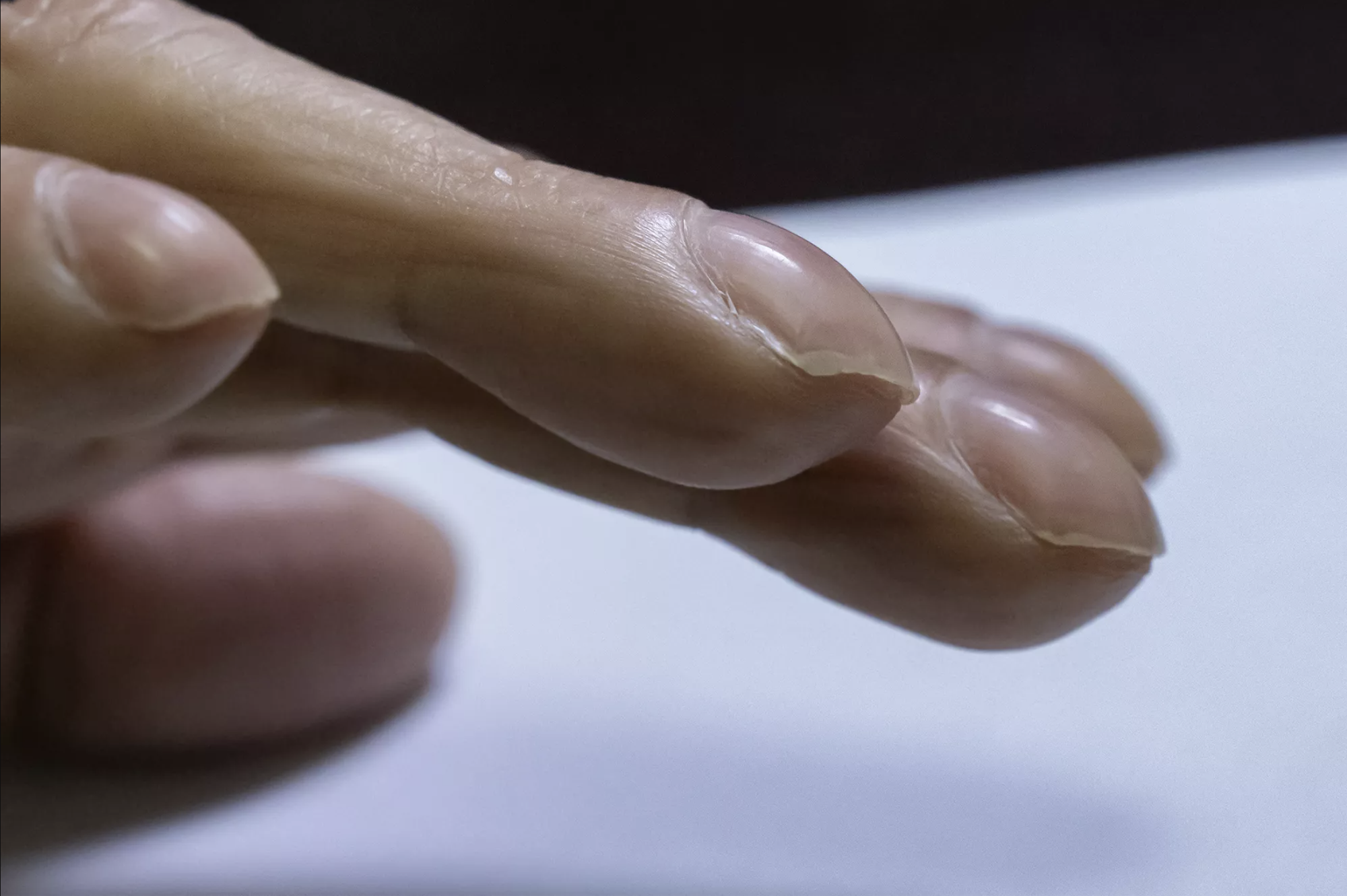 5 Giây Kiểm Tra Tay Giúp Phát Hiện Sớm Nguy Cơ Mắc Ung Thư: Ai Cũng Làm Được- Ảnh 2. 5 Giây Kiểm Tra Tay Giúp Phát Hiện Sớm Nguy Cơ Mắc Ung Thư: Ai Cũng Làm Được- Ảnh 2.