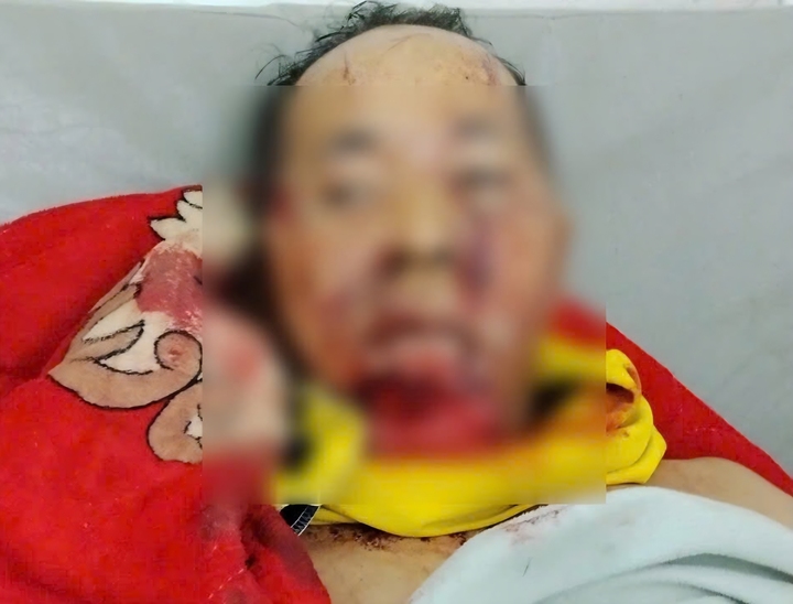 Trưởng thôn ở Đà Nẵng bị gấu rừng tấn công- Ảnh 1. Trưởng thôn ở Đà Nẵng bị gấu rừng tấn công- Ảnh 1.