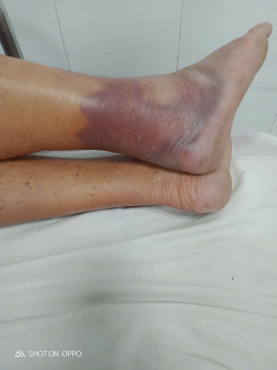 Đà Nẵng: Chưa có căn cứ xác định người đàn ông tử vong do tiêm thuốc- Ảnh 2. Đà Nẵng: Chưa có căn cứ xác định người đàn ông tử vong do tiêm thuốc- Ảnh 2.