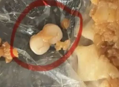 Hãi hùng: Phát hiện răng giả trong bánh, xúc xích, dimsum - Dư luận Trung Quốc dậy sóng- Ảnh 1. Hãi hùng: Phát hiện răng giả trong bánh, xúc xích, dimsum - Dư luận Trung Quốc dậy sóng- Ảnh 1.