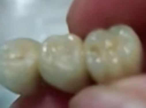 Hãi hùng: Phát hiện răng giả trong bánh, xúc xích, dimsum - Dư luận Trung Quốc dậy sóng- Ảnh 3. Hãi hùng: Phát hiện răng giả trong bánh, xúc xích, dimsum - Dư luận Trung Quốc dậy sóng- Ảnh 3.