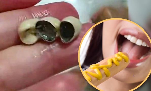 Hãi hùng: Phát hiện răng giả trong bánh, xúc xích, dimsum - Dư luận Trung Quốc dậy sóng- Ảnh 2. Hãi hùng: Phát hiện răng giả trong bánh, xúc xích, dimsum - Dư luận Trung Quốc dậy sóng- Ảnh 2.