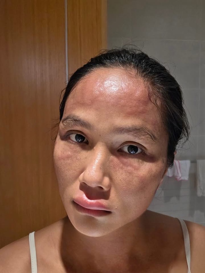 H'hen Niê mắc bệnh sau sinh - Ảnh 1.