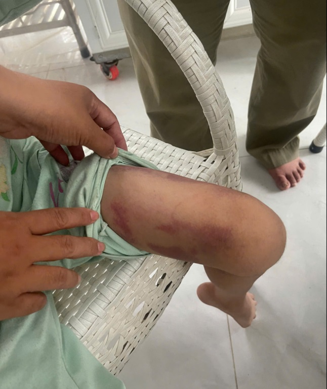 Mẹ ruột và người tình 19 tuổi thay nhau bạo hành dã man con gái 9 tuổi- Ảnh 1. Mẹ ruột và người tình 19 tuổi thay nhau bạo hành dã man con gái 9 tuổi- Ảnh 1.