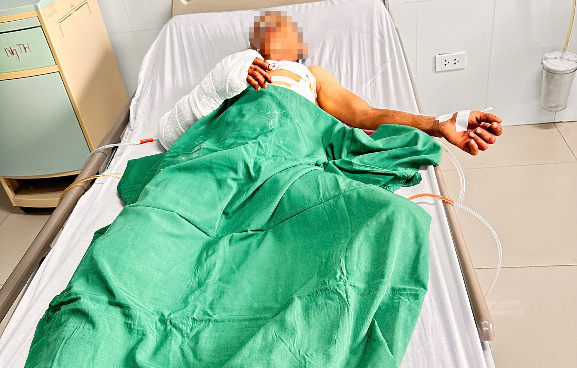 Công an thông tin vụ đôi nam nữ bị truy sát trong phòng trọ- Ảnh 1. Công an thông tin vụ đôi nam nữ bị truy sát trong phòng trọ- Ảnh 1.