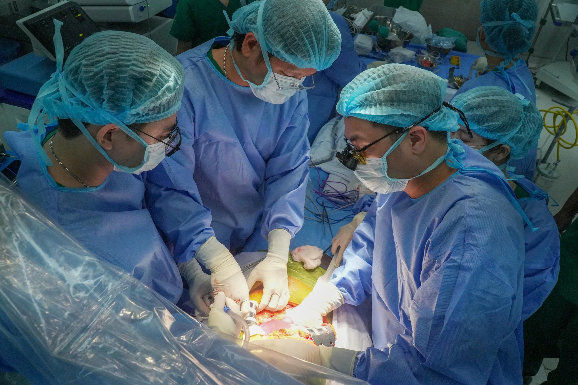 Thêm một bệnh viện ở TP HCM làm chủ kỹ thuật ghép gan- Ảnh 3. Thêm một bệnh viện ở TP HCM làm chủ kỹ thuật ghép gan- Ảnh 3.