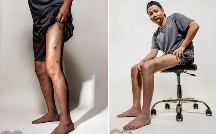 T&igrave;nh trạng bất ổn của Khoa Pug