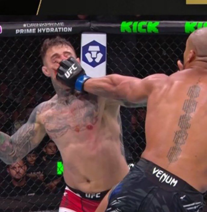 Cao thủ muay Thái chọc mắt nhà vô địch UFC, trọng tài ra quyết định chưa từng có- Ảnh 1. Cao thủ muay Thái chọc mắt nhà vô địch UFC, trọng tài ra quyết định chưa từng có- Ảnh 1.