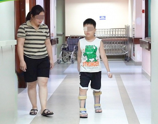 Bước ngoặt điều trị bại não tại Việt Nam- Ảnh 4.