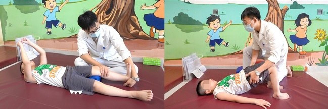 Bước ngoặt điều trị bại não tại Việt Nam- Ảnh 3.