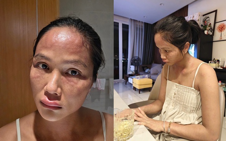 Nhà Beckham không thể hàn gắn với con dâu, Victoria khóc lóc bỏ về- Ảnh 3. Chuyện gì xảy ra với H'Hen Niê sau khi xuất hiện với gương mặt khác lạ