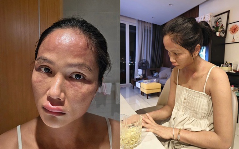 Chuyện gì xảy ra với H'Hen Niê sau khi xuất hiện với gương mặt khác lạ- Ảnh 1. Chuyện gì xảy ra với H'Hen Niê sau khi xuất hiện với gương mặt khác lạ- Ảnh 1.