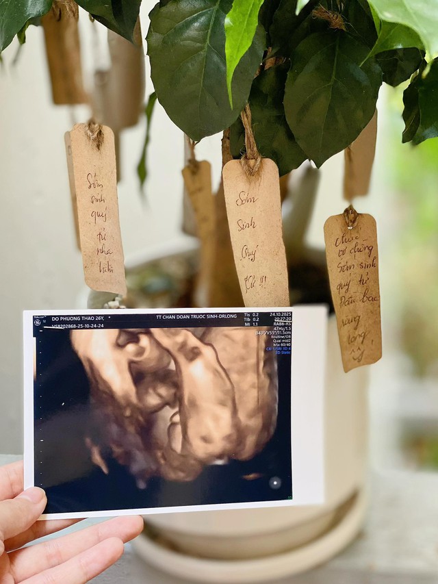 Sao nam Vbiz và vợ yêu 9 năm thông báo có con sau 7 tháng kết hôn- Ảnh 1. Sao nam Vbiz và vợ yêu 9 năm thông báo có con sau 7 tháng kết hôn- Ảnh 1.