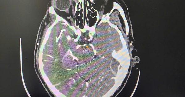 Việt Nam sở hữu &ldquo;tr&aacute;i c&acirc;y hạnh ph&uacute;c&rdquo; h&uacute;t mạnh thị trường Trung Quốc, Nhật Bản: H&agrave;ng loạt lợi &iacute;ch bất ngờ- Ảnh 2.