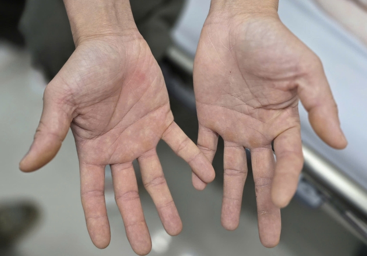 Liệt tứ chi vì 'thú vui' bóng cười- Ảnh 1.