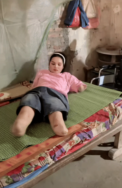 NGA TÍCH CỰC - Kênh Tiktok của mẹ 2 con mất tứ chi sau cơn bạo bệnh: Kiên cường tập luyện với đôi chân 