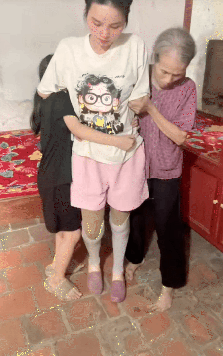 NGA TÍCH CỰC - Kênh Tiktok của mẹ 2 con mất tứ chi sau cơn bạo bệnh: Kiên cường tập luyện với đôi chân 