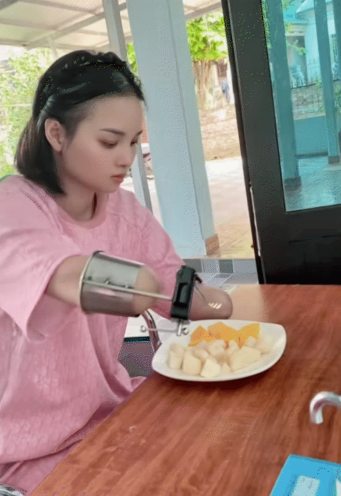 NGA TÍCH CỰC - Kênh Tiktok của mẹ 2 con mất tứ chi sau cơn bạo bệnh: Kiên cường tập luyện với đôi chân 