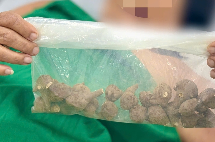 Sắc 5 củ ấu tẩu uống chữa đau khớp, cụ bà sốc tim suýt tử vong- Ảnh 2.