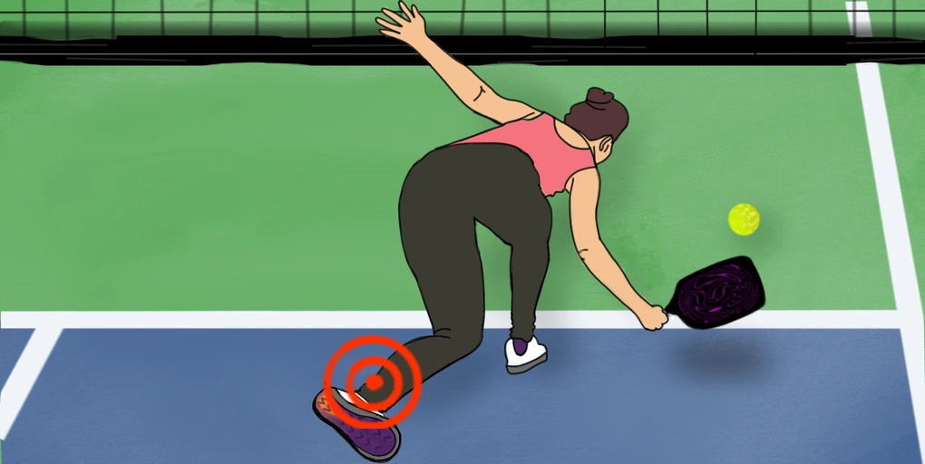 Nam diễn viên "Lật mặt 7" đứt hoàn toàn gân gót chân khi chơi pickleball: Bác sĩ cảnh báo khẩn!- Ảnh 3. Nam diễn viên "Lật mặt 7" đứt hoàn toàn gân gót chân khi chơi pickleball: Bác sĩ cảnh báo khẩn!- Ảnh 3.