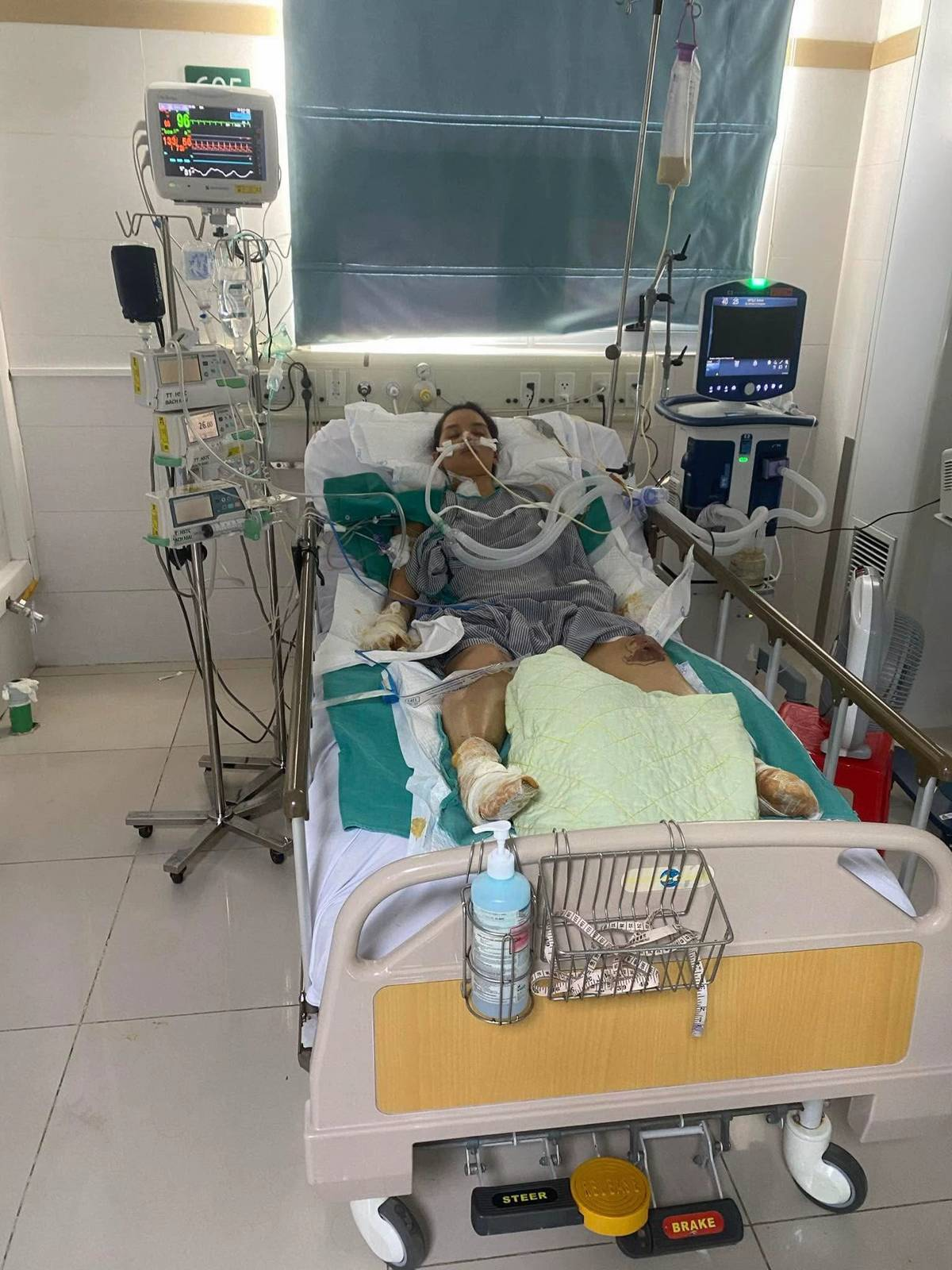 NGA TÍCH CỰC - Kênh Tiktok của mẹ 2 con mất tứ chi sau cơn bạo bệnh: Kiên cường tập luyện với đôi chân 