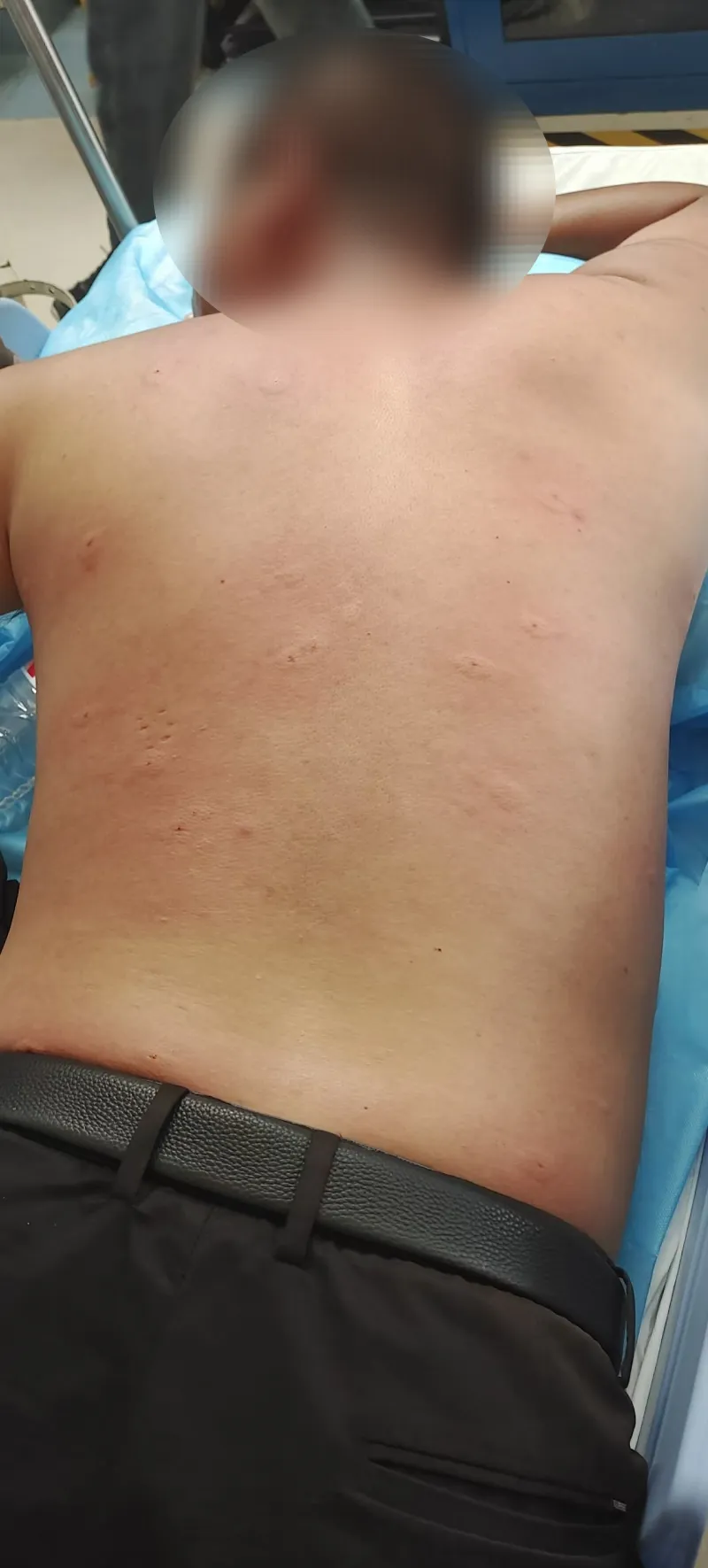 Mở cửa phòng, người đàn ông bị "hàng trăm mũi kim cắm khắp người"- Ảnh 3.