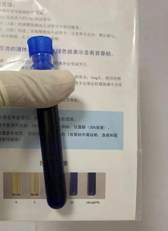 Người đàn ông có nước tiểu "đen kịt": Bác sĩ cảnh báo "thứ này chứa độc, uống vào phá gan, hại thận"- Ảnh 1.