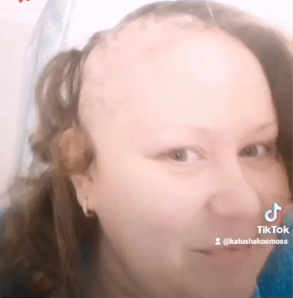 Rúng động “Squid Game bản đời thật”: Cô gái 17 tuổi tự thiêu, cha mẹ xăm lên tay con mới 1 tuổi… để thắng cuộc một trò chơi trên mạng- Ảnh 3. Rúng động “Squid Game bản đời thật”: Cô gái 17 tuổi tự thiêu, cha mẹ xăm lên tay con mới 1 tuổi… để thắng cuộc một trò chơi trên mạng- Ảnh 3.