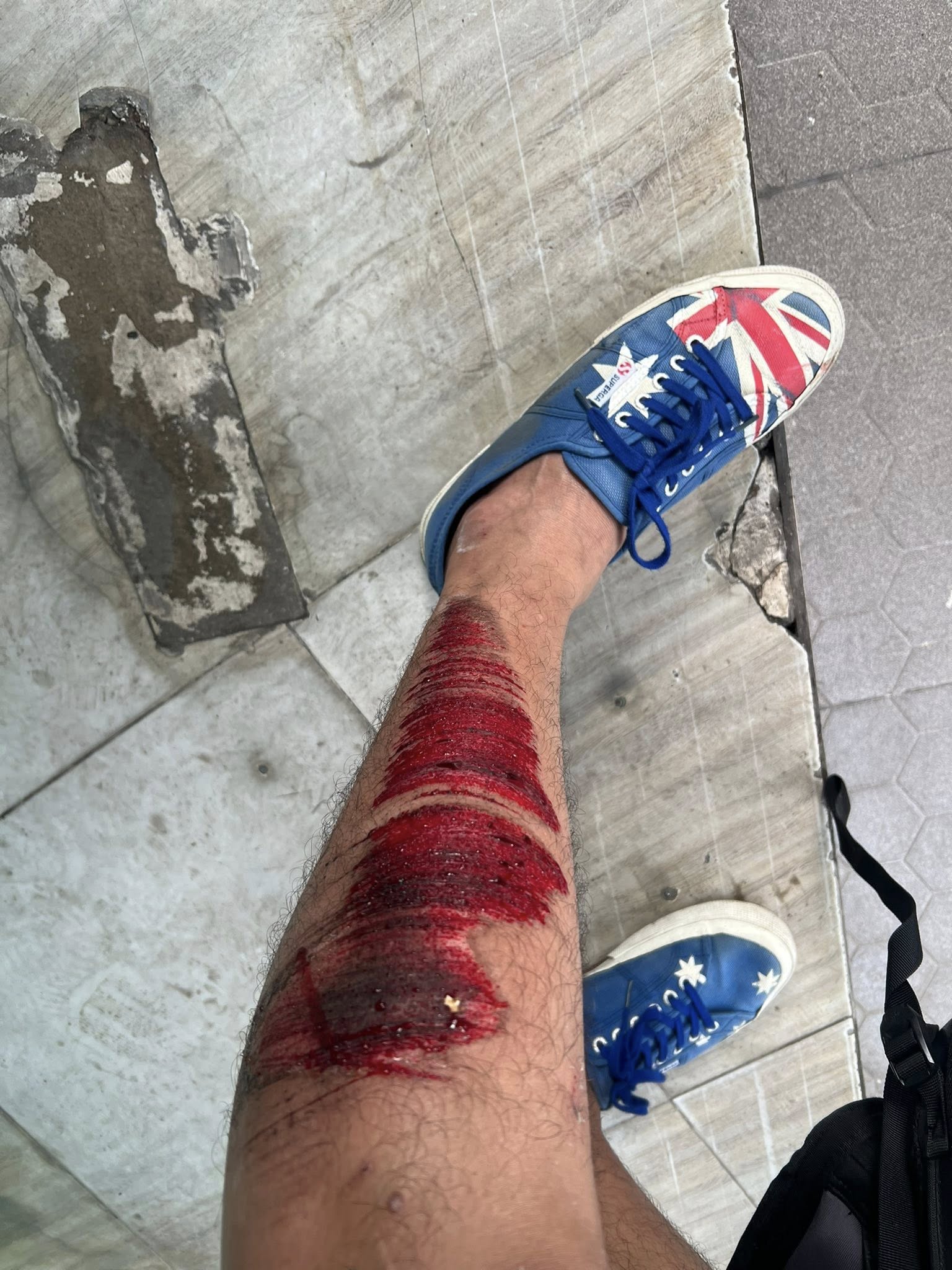 Quách Ngọc Tuyên bị tai nạn- Ảnh 2. Quách Ngọc Tuyên bị tai nạn- Ảnh 2.