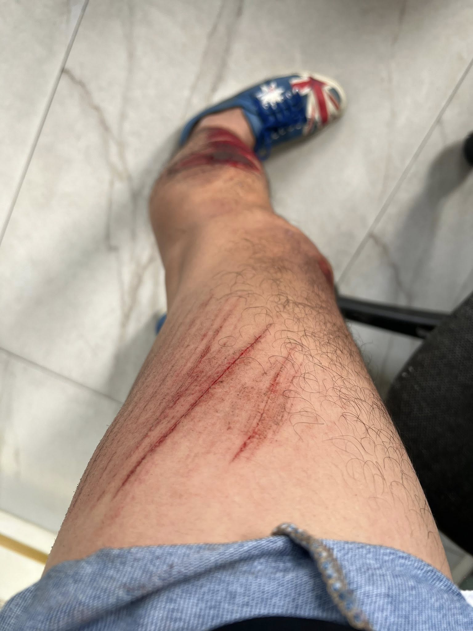 Quách Ngọc Tuyên bị tai nạn- Ảnh 3. Quách Ngọc Tuyên bị tai nạn- Ảnh 3.