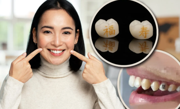 Sốc với mốt "xăm răng" ở Trung Quốc: Giới trẻ khắc chữ "làm giàu", "thành công" ngay trên răng- Ảnh 2. Sốc với mốt "xăm răng" ở Trung Quốc: Giới trẻ khắc chữ "làm giàu", "thành công" ngay trên răng- Ảnh 2.