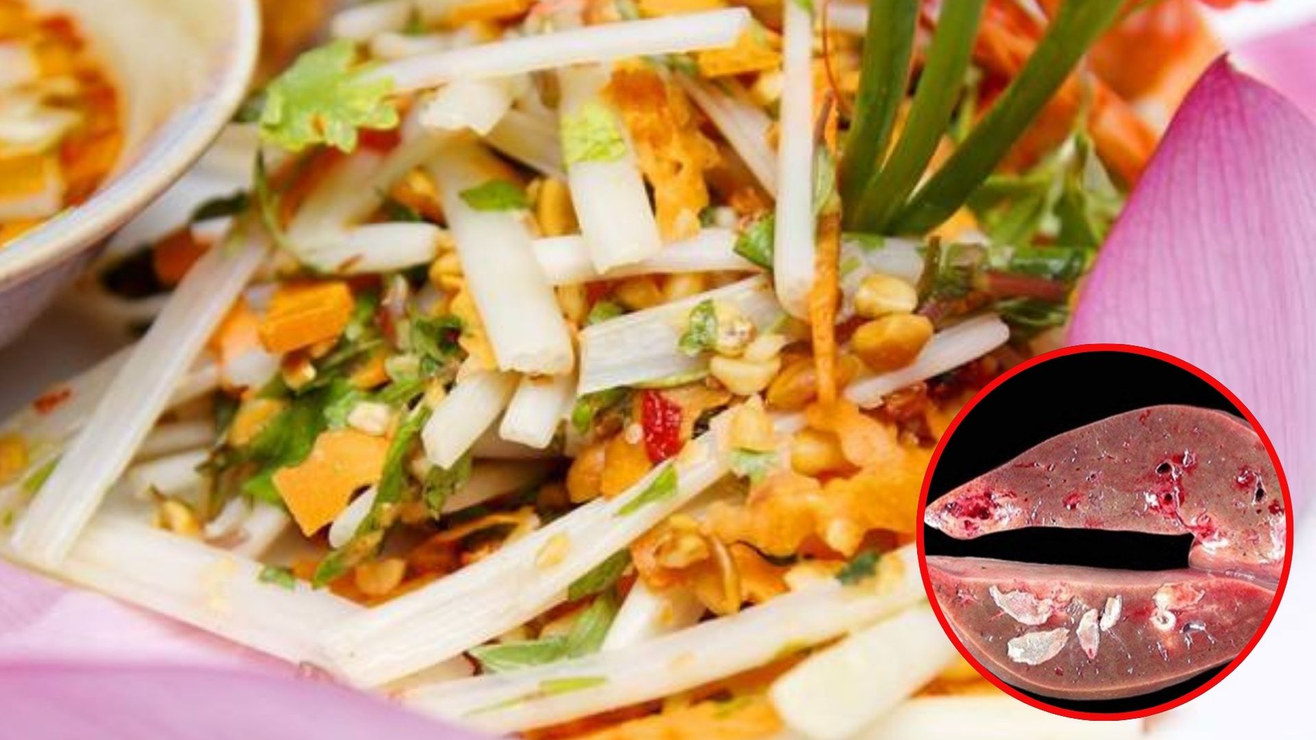 Chủ quán bất ngờ nhận tin gan bị tổn thương nặng vì chính món ăn mình bán mỗi ngày- Ảnh 1. Chủ quán bất ngờ nhận tin gan bị tổn thương nặng vì chính món ăn mình bán mỗi ngày- Ảnh 1.