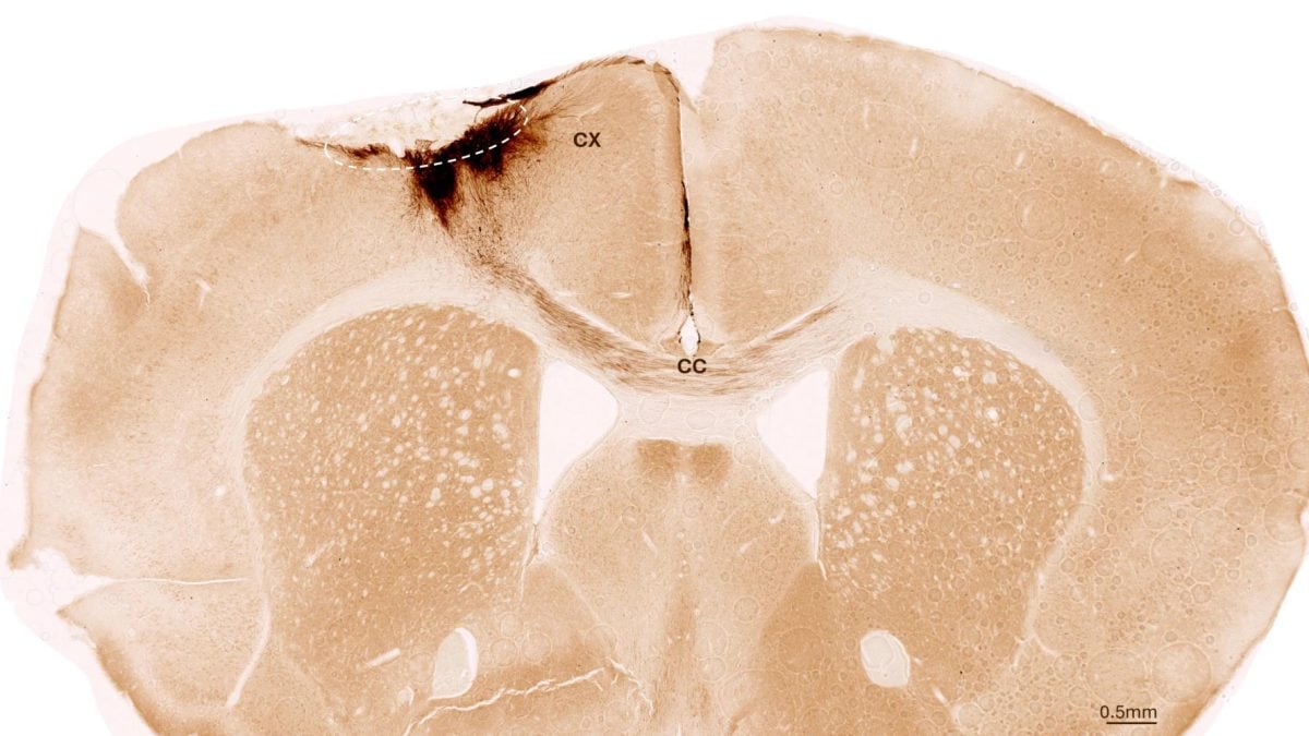 Tìm ra phương pháp mới hứa hẹn “đảo ngược” đột quỵ- Ảnh 1.