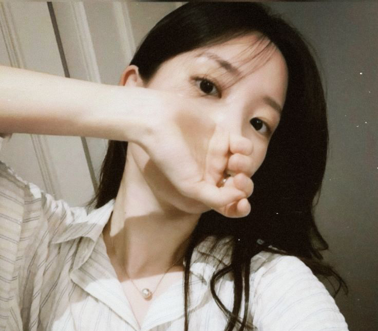 Xuất hiện 4 thứ m&agrave;u đen n&agrave;y tr&ecirc;n mặt th&igrave; phải kh&aacute;m thận sớm, trường hợp xấu nhất l&agrave;... ung thư- Ảnh 1.