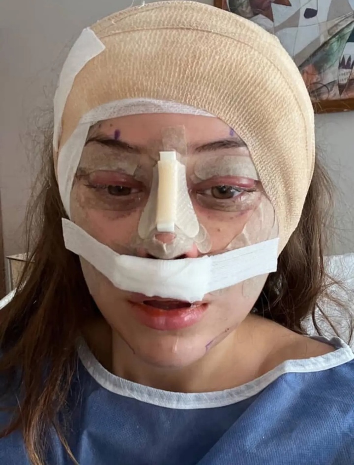 Sợ già đến ám ảnh, các cô gái tuổi 20 đua nhau làm phẫu thuật dành cho U60- Ảnh 2. Sợ già đến ám ảnh, các cô gái tuổi 20 đua nhau làm phẫu thuật dành cho U60- Ảnh 2.