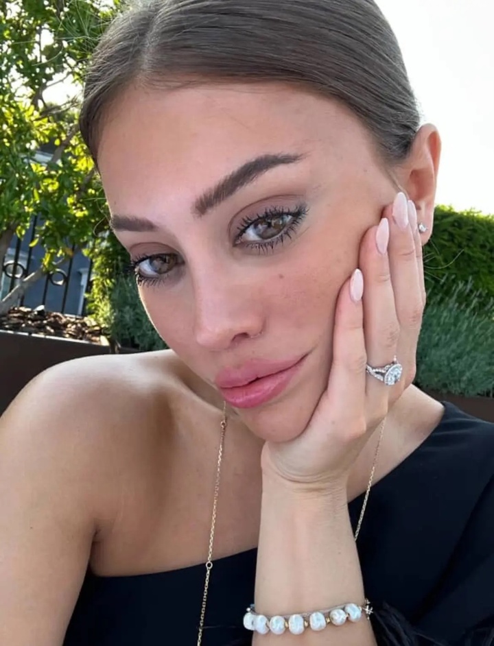 Sợ già đến ám ảnh, các cô gái tuổi 20 đua nhau làm phẫu thuật dành cho U60- Ảnh 4. Sợ già đến ám ảnh, các cô gái tuổi 20 đua nhau làm phẫu thuật dành cho U60- Ảnh 4.