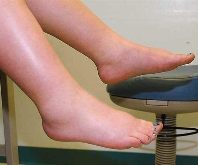 "Soi" chân bắt bệnh: 5 dấu hiệu cho thấy lá gan đang “kiệt sức”, nguy cơ UNG THƯ cận kề- Ảnh 1. "Soi" chân bắt bệnh: 5 dấu hiệu cho thấy lá gan đang “kiệt sức”, nguy cơ UNG THƯ cận kề- Ảnh 1.