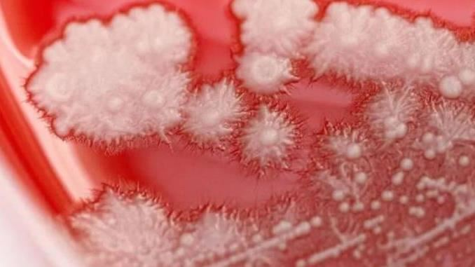 Người đàn ông "họng trắng như tuyết" vì thói quen này của nhiều người- Ảnh 1.