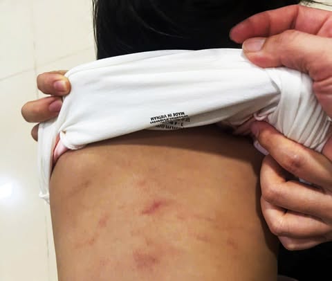 Vụ bé gái 2 tuổi ở Cà Mau bị bạo hành: Sau nửa tháng, bé vẫn hoảng loạn và sợ nơi đông người- Ảnh 1. Vụ bé gái 2 tuổi ở Cà Mau bị bạo hành: Sau nửa tháng, bé vẫn hoảng loạn và sợ nơi đông người- Ảnh 1.