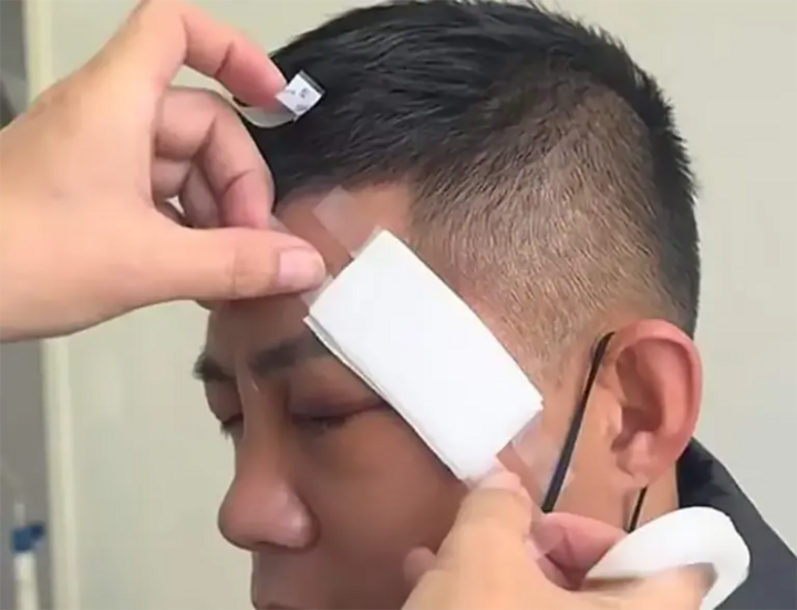 Võ sĩ Trung Quốc nguy cơ thương tật mắt vĩnh viễn khi bị hạ đo ván ở nước ngoài- Ảnh 4.