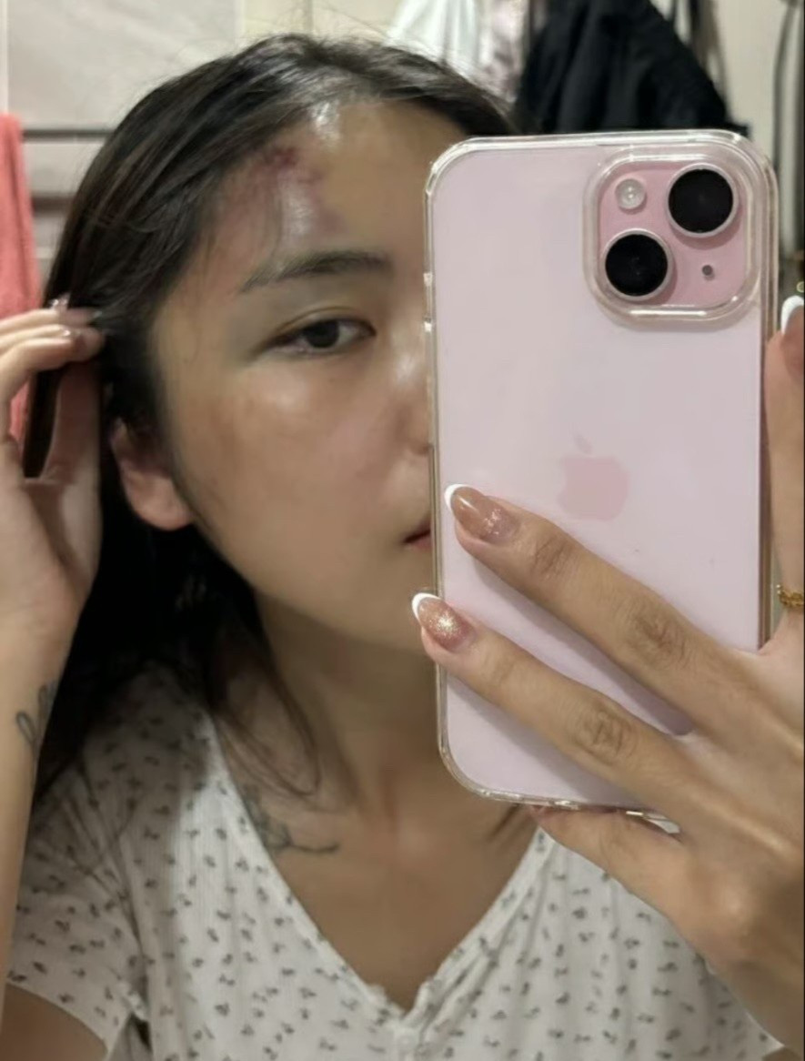 Hà Nội: Chồng đánh vợ thủng màng nhĩ, chấn động não ngay trước mắt hàng xóm- Ảnh 1.